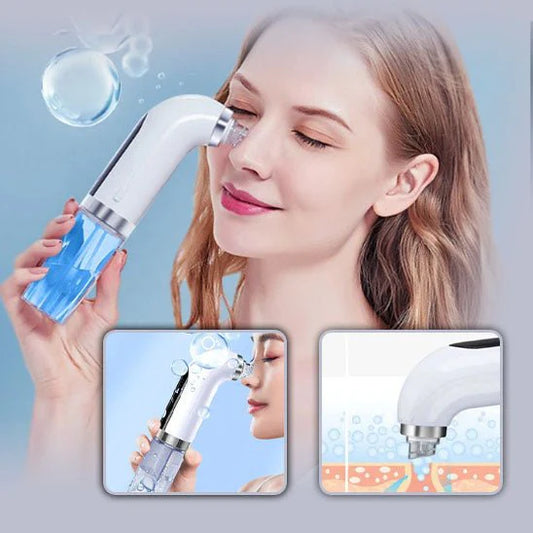 Extracteur de points noirs et nettoyeur de pores électrique pour le visage, anti-acné, rechargeable par USB, à circulation d'eau